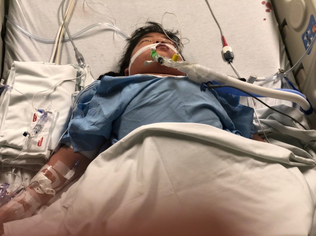 Lilyan Immediatley PostOp #1