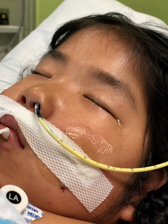 No Extubation 3/23/19 #1