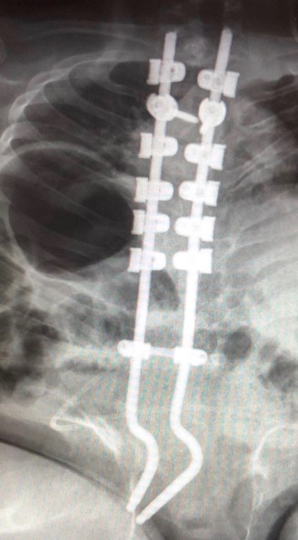 Lilyan's Hardware broken #2