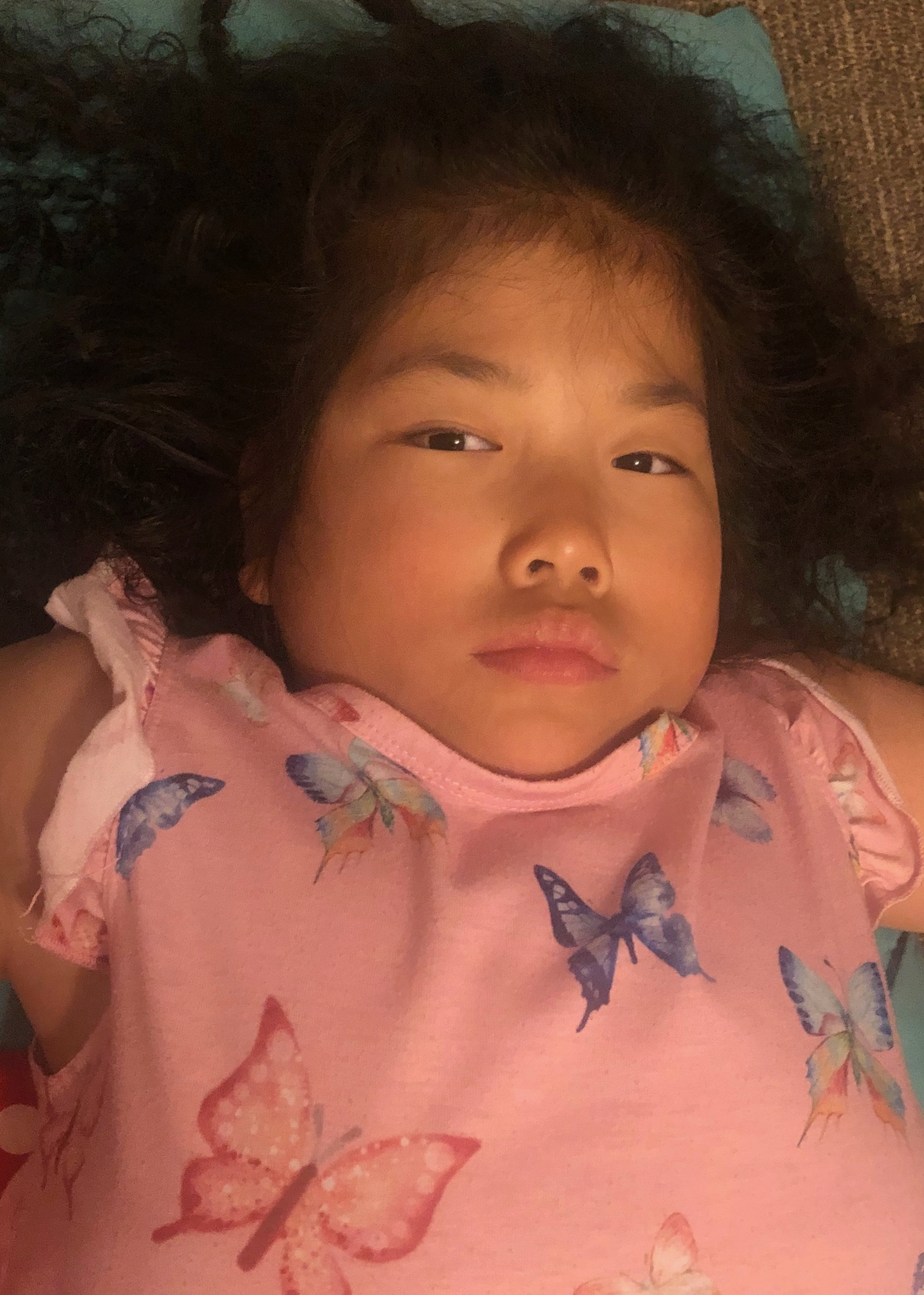 Lilyan - broken knee 4/23/20